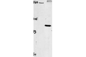 Western Blotting (WB) image for anti-Chloride Channel 4 (CLCN4) antibody (ABIN3002620)