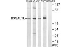 Western blot analysis of extracts from HuvEc/MCF-7/Jurkat/HepG2 cells, using B3GALTL Antibody.