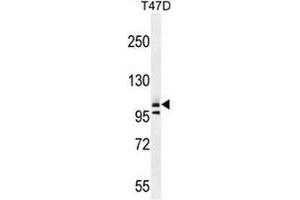 COL1A2 Antibody (N-term) western blot analysis in T47D cell line lysates (35µg/lane). (COL1A2 antibody  (Chain alpha 2, N-Term))