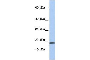 WB Suggested Anti-IL1A Antibody Titration: 0. (IL1A antibody  (N-Term))
