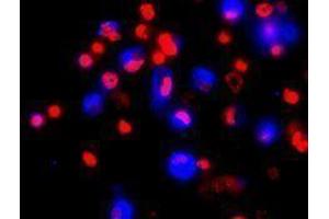 Immunofluorescence (IF) image for anti-Lysosomal-Associated Membrane Protein 2 (LAMP2) antibody (Alexa Fluor 647) (ABIN2657608) (LAMP2 antibody  (Alexa Fluor 647))
