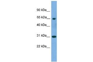 WB Suggested Anti-PNKP Antibody Titration: 0. (PNKP antibody  (Middle Region))