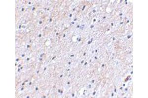 Immunohistochemical staining of human brain tissue using NIPSNAP1 polyclonal antibody  at 2.
