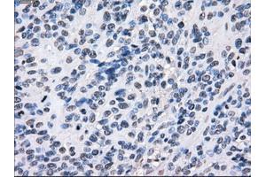 Image no. 10 for anti-Budding Uninhibited By Benzimidazoles 1 Homolog beta (Yeast) (BUB1B) antibody (ABIN1496996) (BUB1B antibody)