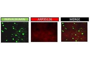 mouse PFC (KCNAB1 antibody  (C-Term))