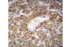 CXCL12 antibody immunohistochemistry analysis in formalin fixed and paraffin embedded human liver tissue. (CXCL12 antibody  (AA 64-92))