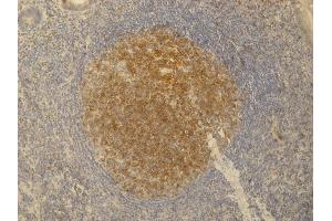 Immunohistochemistry staining (paraffin sections) of PAG/Cbp in germinal center of lymphatic follicle and in dispersed T cells in appendix tissue by monoclonal antibody. (PAG1 antibody  (C-Term))