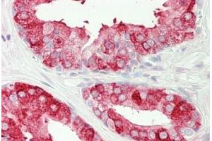 Human Prostate: Formalin-Fixed, Paraffin-Embedded (FFPE) (Tachykinin 3 antibody  (AA 54-83))