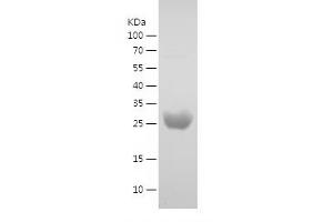 Western Blotting (WB) image for Uridine-Cytidine Kinase 2 (UCK2) (AA 2-261) protein (His tag) (ABIN7282986) (UCK2 Protein (AA 2-261) (His tag))