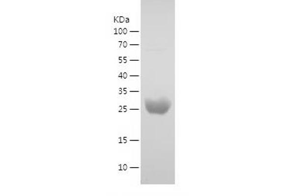 UCK2 Protein (AA 2-261) (His tag)