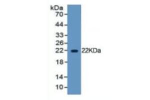Western Blotting (WB) image for High Mobility Group Box 1 (HMGB1) ELISA Kit (ABIN6574156)