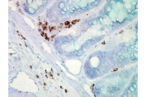 Image no. 2 for anti-Heat Shock Protein 70 (HSP70) (AA 436-503) antibody (ABIN466875) (HSP70 antibody  (AA 436-503))