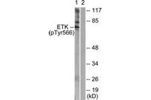 Western blot analysis of extracts from HeLa cells treated with Serum 20% 15', using ETK (Phospho-Tyr566) Antibody. (BMX antibody  (pTyr566))