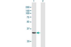 Western Blot analysis of MPST expression in transfected 293T cell line by MPST MaxPab polyclonal antibody.