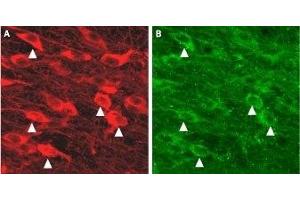 Expression of KCa2. (KCNN3 antibody  (Intracellular))