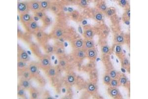 Figure. (SFRP4 antibody  (AA 27-154))