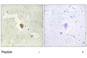 Immunohistochemistry analysis of paraffin-embedded human brain tissue using ADCY7 polyclonal antibody .