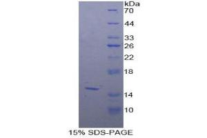 SDS-PAGE (SDS) image for Biglycan (BGN) (AA 53-166) protein (His tag) (ABIN1098898)