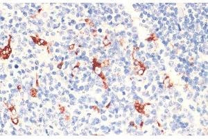 Immunohistochemistry of paraffin-embedded Human tonsil using CD68 Polyclonal Antibody at dilution of 1:100 (40x lens).