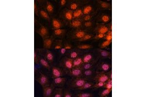 Immunofluorescence analysis of C6 cells using CHTF18 antibody (ABIN7266535) at dilution of 1:100. (CTF18 antibody  (AA 794-975))
