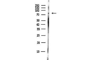anti-Erythrocyte Membrane Protein Band 4.1 Like 5 (EPB41L5) antibody