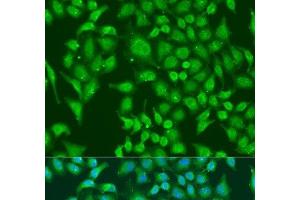 Immunofluorescence analysis of U2OS cells using CENPQ Polyclonal Antibody at dilution of 1:100. (CENPQ antibody)