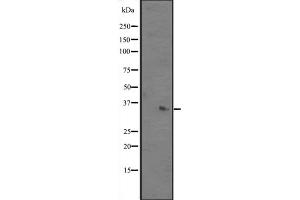 Western blot analysis of ALKBH3 expression in Mouse kidney tissue lysates ;,The lane on the left is treated with the antigen-specific peptide. (ALKBH3 antibody  (Internal Region))