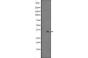 Western blot analysis of ALKBH3 expression in Mouse kidney tissue lysates ;,The lane on the left is treated with the antigen-specific peptide. (ALKBH3 antibody  (Internal Region))