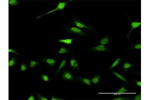 Immunofluorescence of purified MaxPab antibody to ABI2 on HeLa cell.