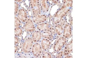 Immunohistochemistry of paraffin-embedded rat kidney using Transportin 3 (Transportin 3 (TNPO3)) Rabbit mAb (ABIN7270971) at dilution of 1:100 (40x lens). (Transportin 3 antibody)