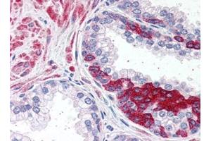 Image no. 1 for anti-ADAM Metallopeptidase Domain 12 (ADAM12) (N-Term) antibody (ABIN372949) (ADAM12 antibody  (N-Term))