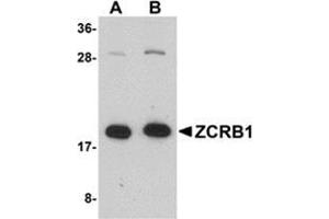 Western blot analysis of ZCRB1 in Raji cell lysate with this product at (A) 1 and (B) 2 μg/ml.