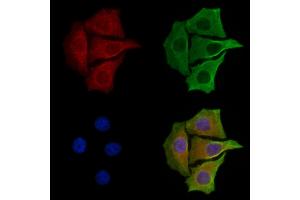 ABIN6258208 and ABIN6273864 staining Hela cells by IF/ICC.