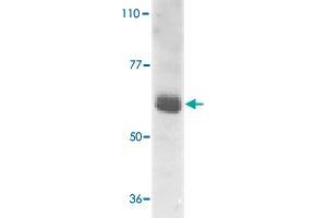 Western blot analysis of IL22RA1 expression in human HepG2 cell lysate with IL22RA1 polyclonal antibody  at 1 ug /mL . (IL22 Receptor alpha 1 antibody  (AA 560-574))