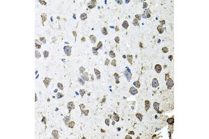 Immunohistochemistry of paraffin-embedded mouse brain using FGF1 antibody. (FGF1 antibody)