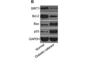Expression of miR-211 and mRNA and protein expressions of SIRT1, Bcl-2, Bax, and p53 in lens tissues of mice(A) miR-211 expression and mRNA and protein expressions of SIRT1, Bcl-2, Bax, and p53 in mice lens, (B) strip chart of SIRT1, Bcl-2, Bax, and p53 proteins, (C) expressions of SIRT1, Bcl-2, Bax, and p53 proteins in mice lens, *, P<0.