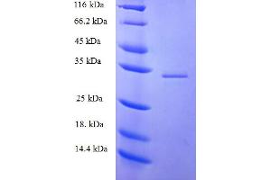 SDS-PAGE (SDS) image for p52K (FAV1GP06) (AA 612-761), (partial) protein (His-SUMO Tag) (ABIN5710147) (p52K Protein (FAV1GP06) (AA 612-761, partial) (His-SUMO Tag))