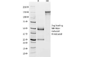 SDS-PAGE Analysis Purified GP2 Mouse Monoclonal Antibody (GP2/1803). (GP2 antibody  (AA 35-179))