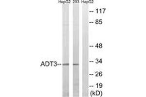 Western blot analysis of extracts from HepG2/293 cells, using SLC25A6 Antibody. (SLC25A6 antibody  (AA 121-170))