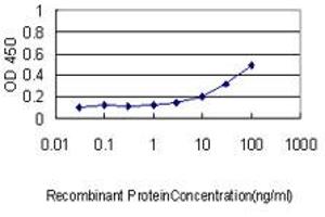 Detection limit for recombinant GST tagged IL11RA is approximately 0. (IL11RA antibody  (AA 1-422))