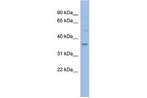 WB Suggested Anti-HMGCLL1 Antibody Titration: 0. (HMGCLL1 antibody  (N-Term))