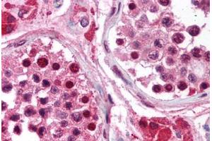 Human Testis (formalin-fixed, paraffin-embedded) stained with RPA3 antibody ABIN214259 at 5 ug/ml followed by biotinylated anti-mouse IgG secondary antibody ABIN481714, alkaline phosphatase-streptavidin and chromogen. (RPA3 antibody)