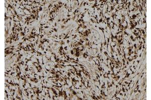 ABIN6278767 at 1/100 staining Human gastric tissue by IHC-P. (LMO7 antibody  (C-Term))