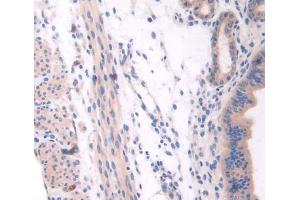 Used in DAB staining on fromalin fixed paraffin- embedded Kidney tissue (NSP5 antibody  (AA 961-1063))