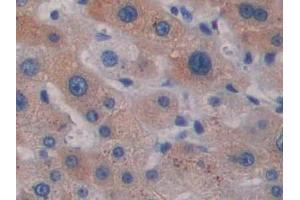 DAB staining on IHC-P; Samples: Simian Liver Tissue