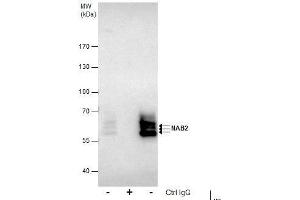 IP Image Immunoprecipitation of NAB2 protein from Jurkat whole cell extracts using 5 μg of NAB2 antibody, Western blot analysis was performed using NAB2 antibody, EasyBlot anti-Rabbit IgG  was used as a secondary reagent. (NAB2 antibody)