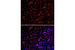 Immunofluorescence analysis of U20S cell using ENOX2 antibody. (ENOX2 antibody)