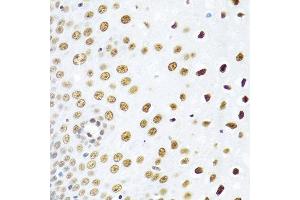 Immunohistochemistry of paraffin-embedded human esophagus using SSB antibody at dilution of 1:100 (40x lens). (SSB antibody)