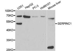 Western blot analysis of extracts of various cell lines, using SERPINC1 antibody. (SERPINC1 antibody  (AA 33-185))