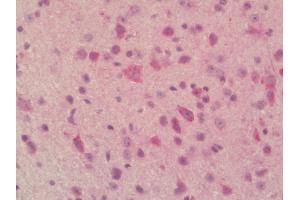 Mouse Brain, Cerebellum: Formalin-Fixed, Paraffin-Embedded (FFPE). (PLBD2 antibody  (FITC))